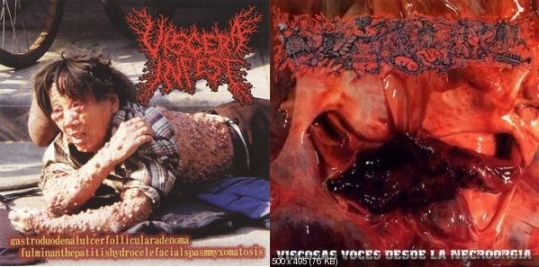 Official CD album cover for 'Gastroduodenalulcerfollicularadenoma fulminanthepatitishydrocelefacialspasmyxomatosis / Viscosas voces desde la necroorgía' by Viscera Infest and Paracoccidioidomicosisproctitissarcomucosis, produced by Rancid Offal Records. A striking representation of brutal death metal artistry.