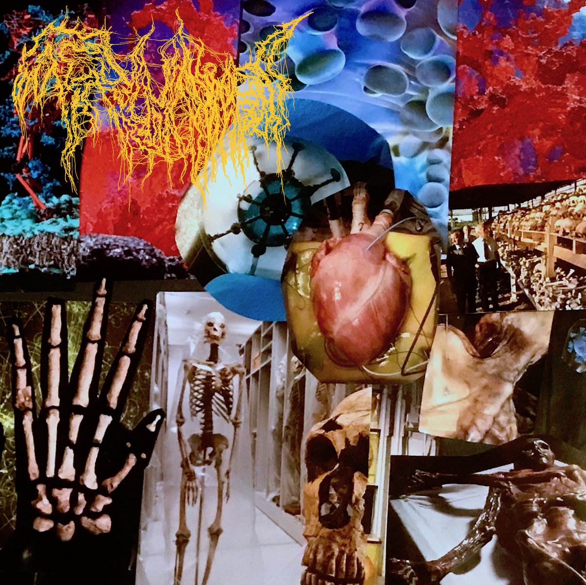 Trichomoniasis - Harvest of the Killing Fields CD, elegantly presented by Rancid Offal Records, featuring brutal death metal tracks, perfect for discerning collectors and aficionados.