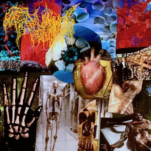 Trichomoniasis - Harvest of the Killing Fields CD, elegantly presented by Rancid Offal Records, featuring brutal death metal tracks, perfect for discerning collectors and aficionados.