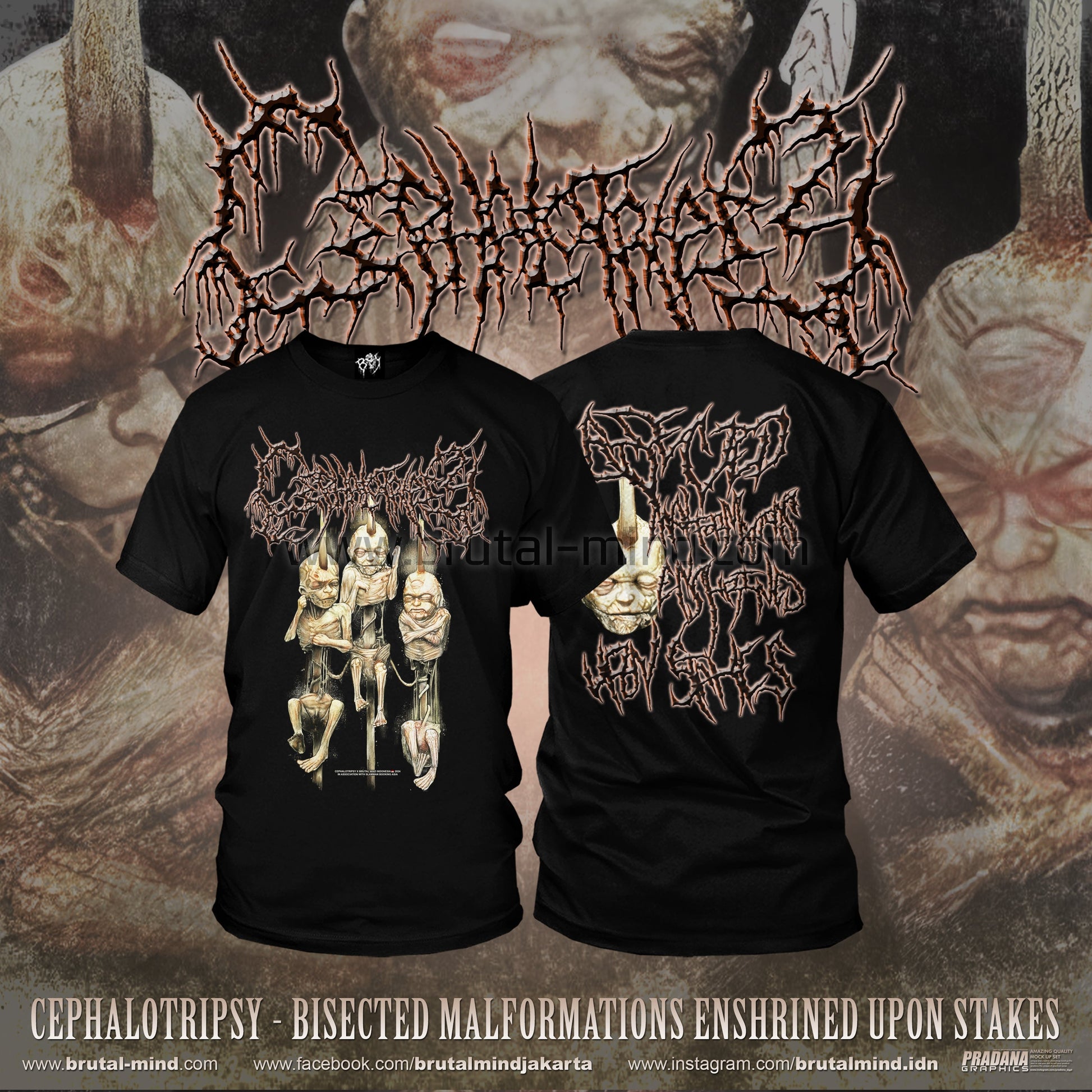 Luxurious Cephalotripsy T-Shirt featuring Bisected Malformations Enshrined Upon Stakes design, crafted by Rancid Offal Records, perfect for fans of high-quality brutal metal merchandise.