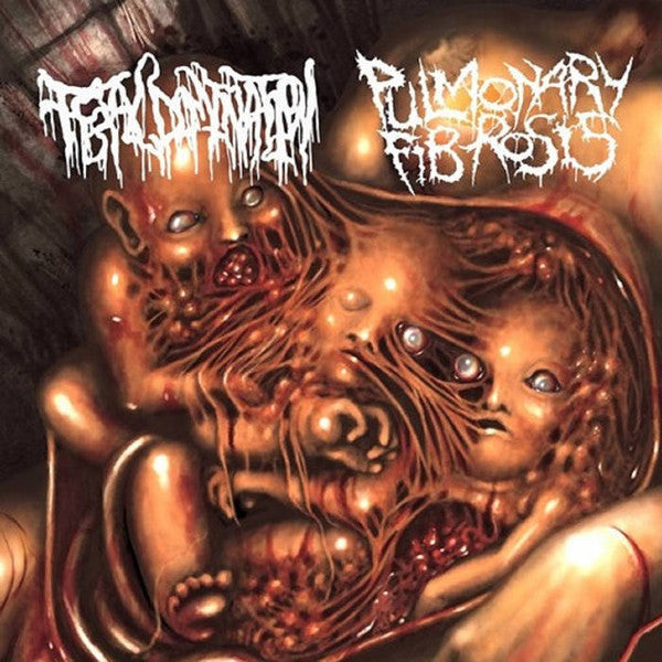 Officially licensed Pulmonary Fibrosis and Fetal Domination Split CD by Rancid Offal Records, showcasing the Goregrind genre with an array of intense tracks, perfect for collectors and enthusiasts.