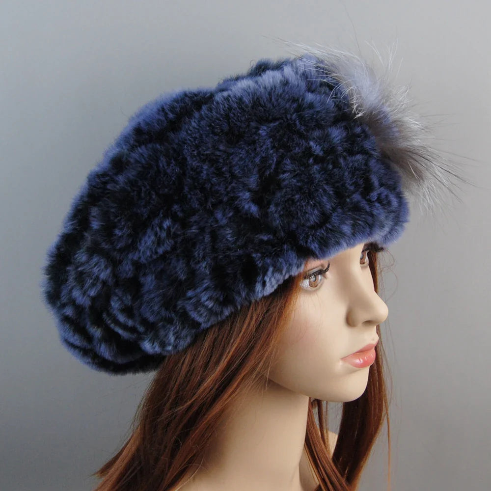 Women’s elegant faux fur winter hat and scarf, showcasing a beautiful striped pattern, perfect for any winter occasion.